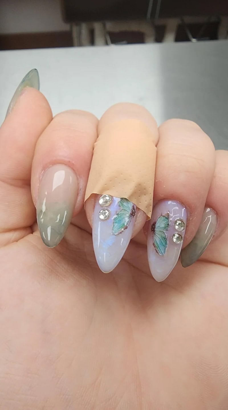 Acrylic nail set with soft watercolor tones and butterfly decals, showing one injured nail covered by a bandage.