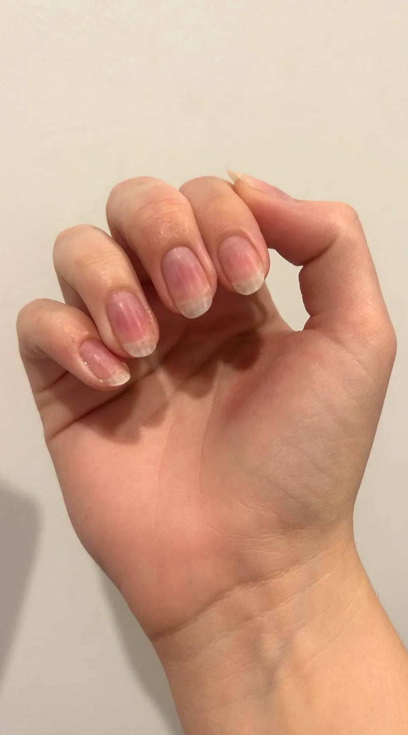 Hand showing moderately grown natural nails with visible improvement in strength and texture.