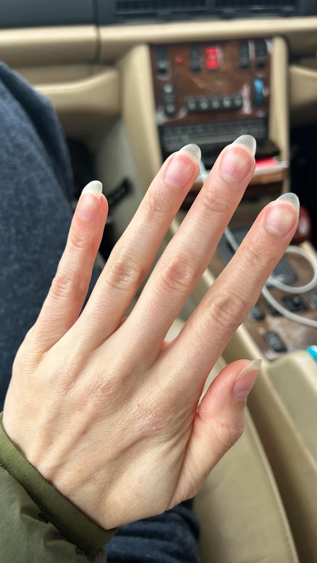 Hand with long, translucent thin nails captured in natural light, highlighting their fragile condition.