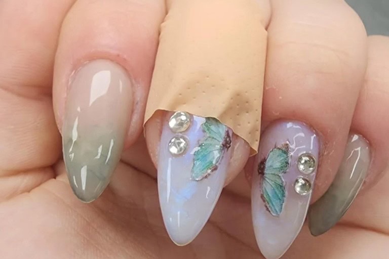 Why Your Nails Really Hurt After Acrylic: Hidden Causes and Fixes That Work