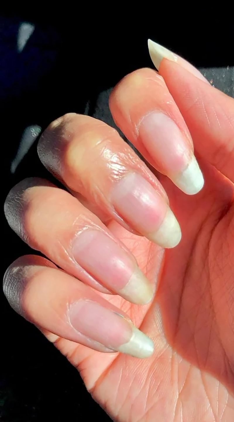 Bare natural nails after gel polish has been removed, showing healthy nail beds in sunlight.