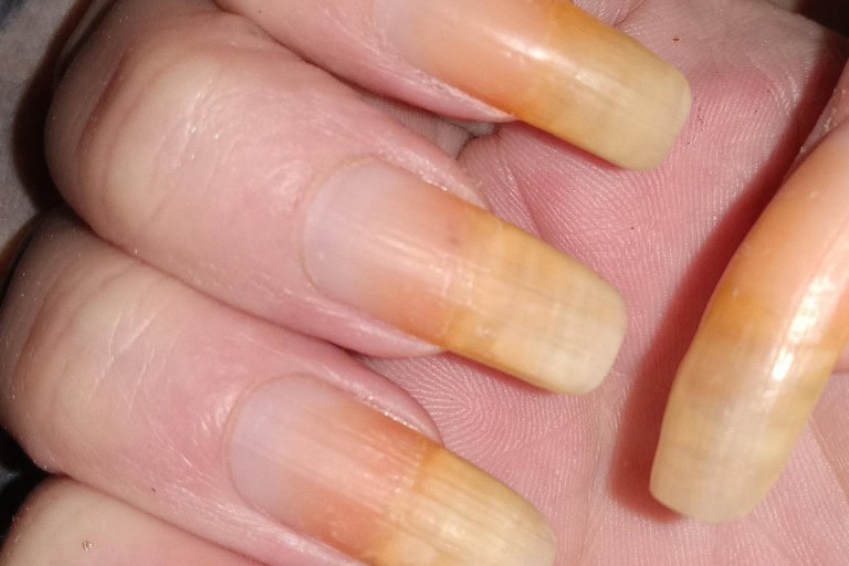 How to Prevent Yellow Nails After Nail Polish: Simple Habits That Make a Big Difference